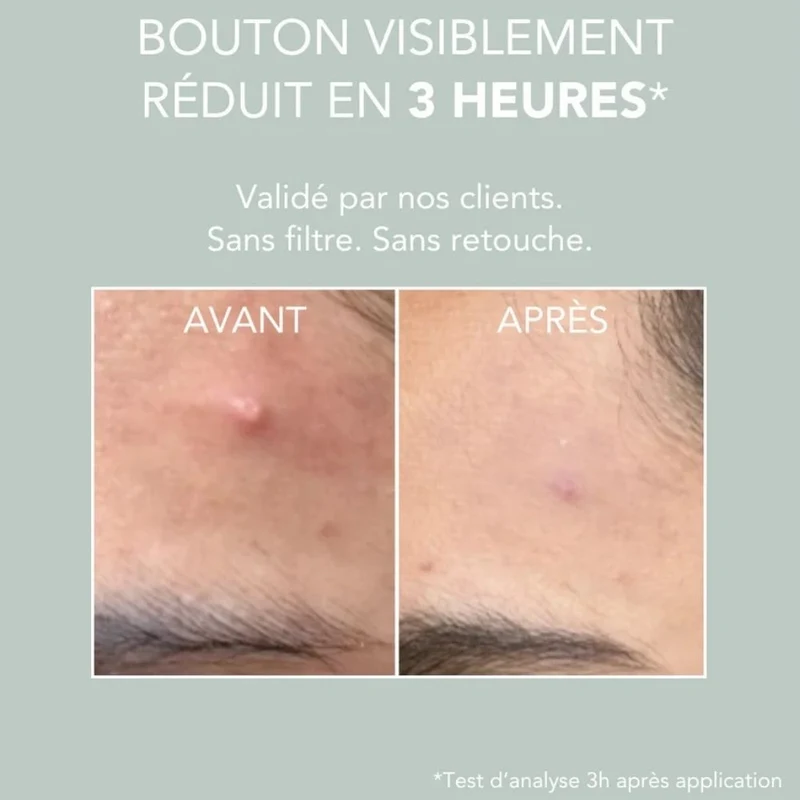 Pâte stop-boutons