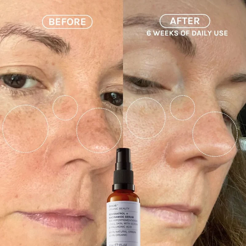 Sérum anti-âge Resveratrol + Niacinamide