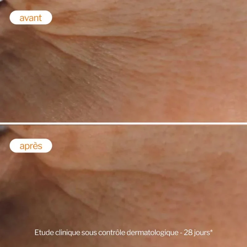 Soin Peeling Éclat Vitamine C