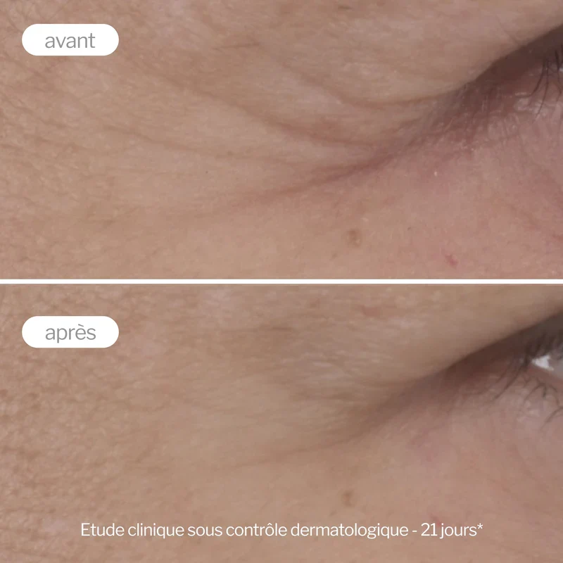 Contour des yeux anti-âge expert Pro-collagène