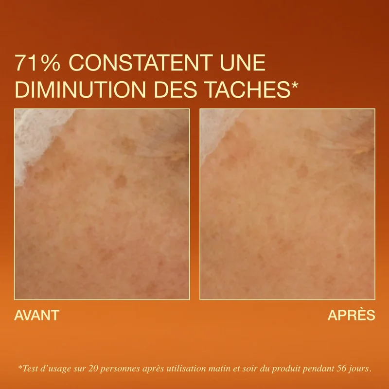 Sérum éclat anti-taches