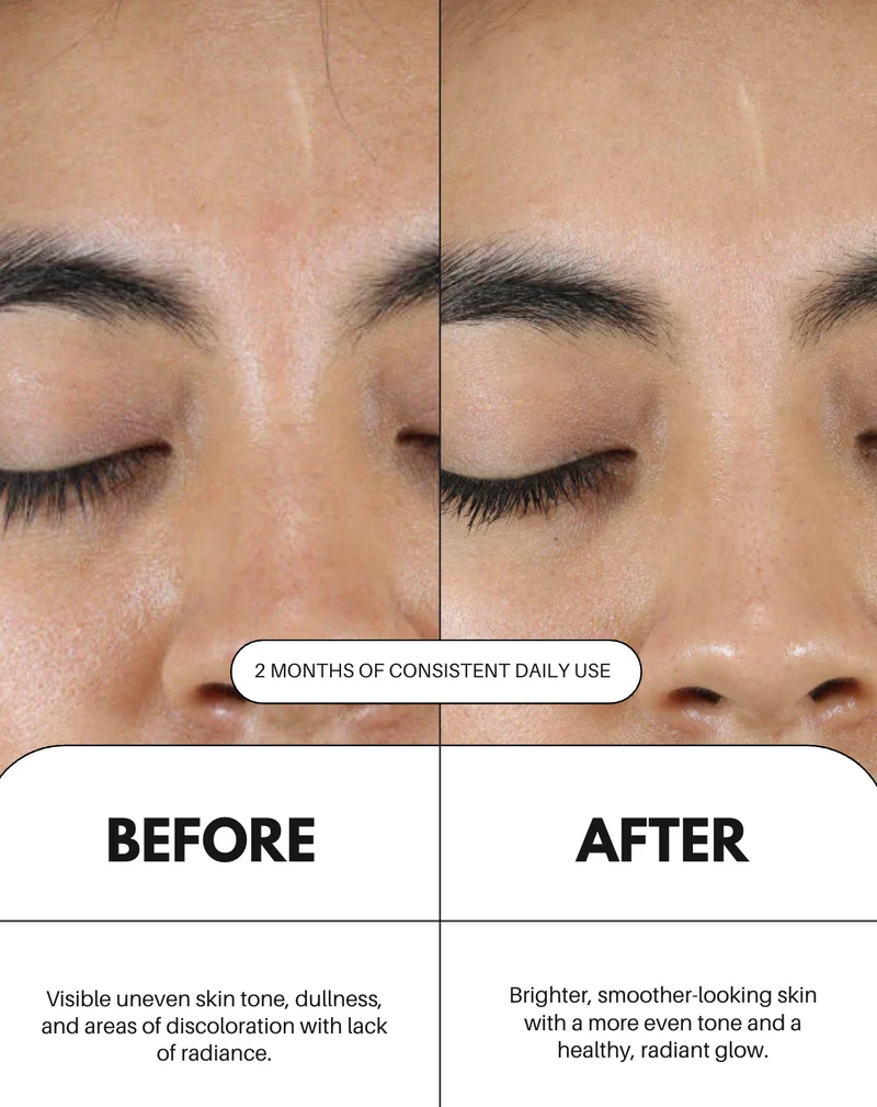 Sérum à la vitamine C pour le visage