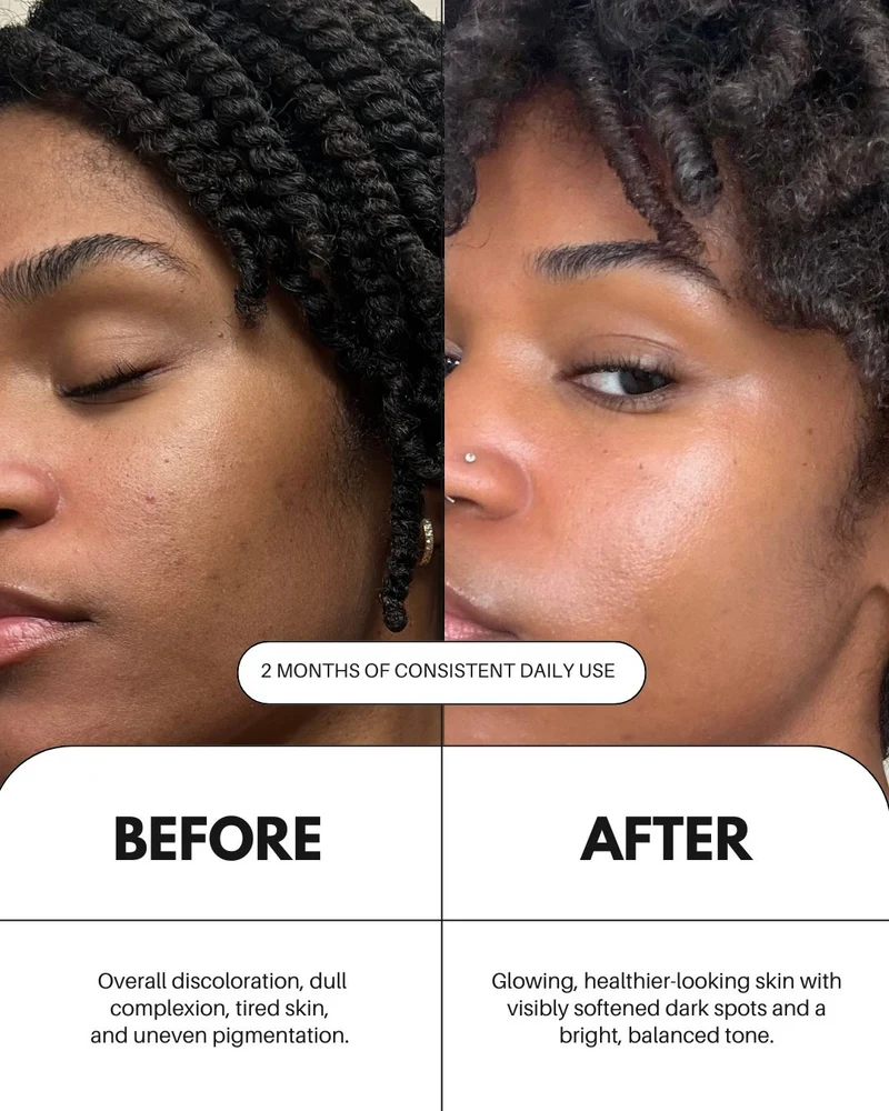 Sérum à la vitamine C pour le visage