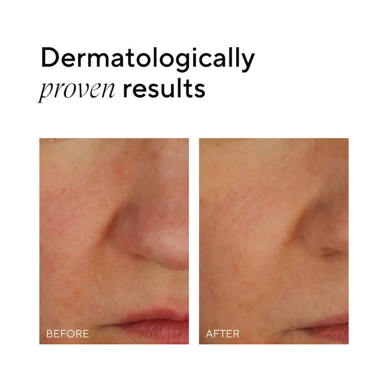 Crème hydratante peau sensible SOS+ Sensitive