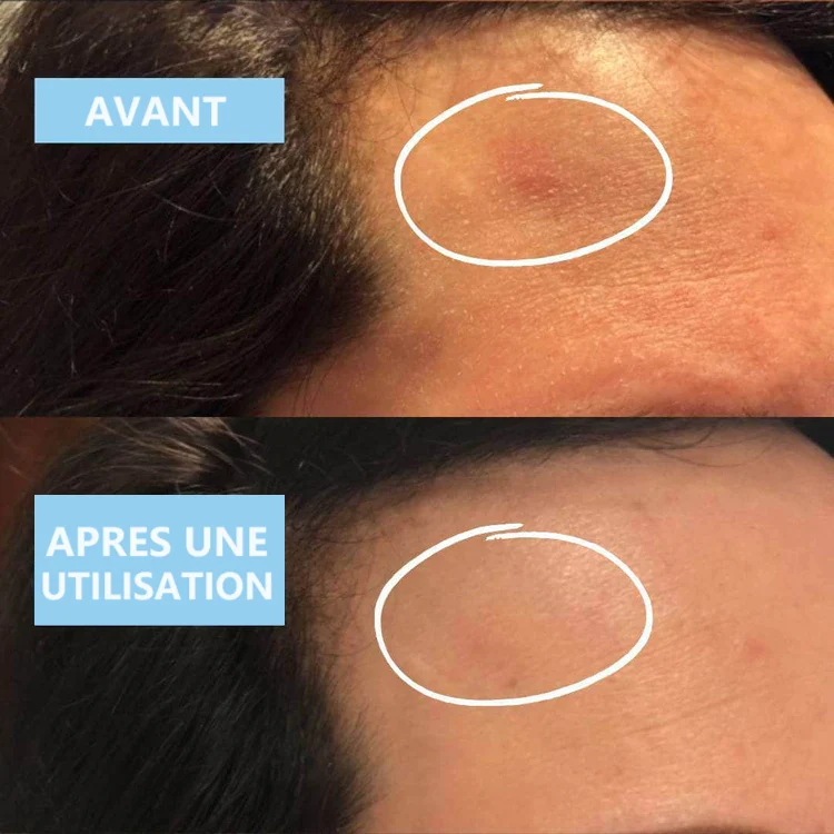 Sérum apaisant - Blue Velvet Ceramide