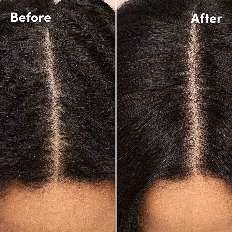 MIZANI SCALP CARE ≡ Shampooing