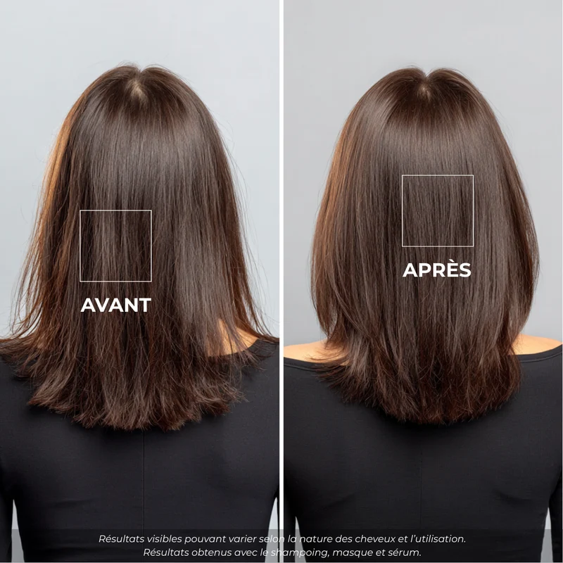 Ensemble ricin 4 pièces – Shampoing au sérum, stop chute