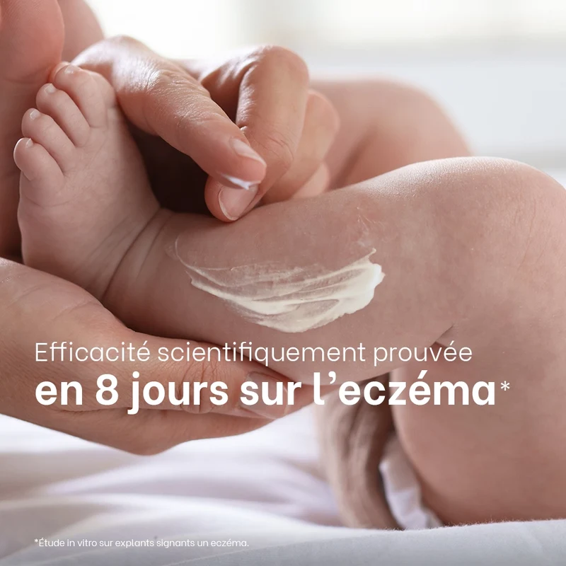 Routine quotidienne eczéma atopique - Bébé