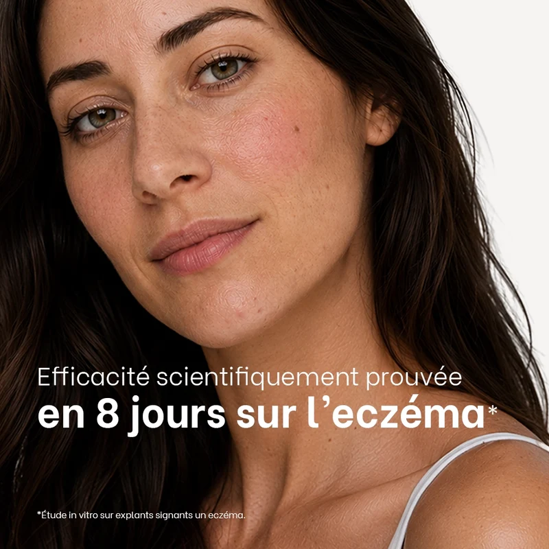 Routine quotidienne eczéma atopique