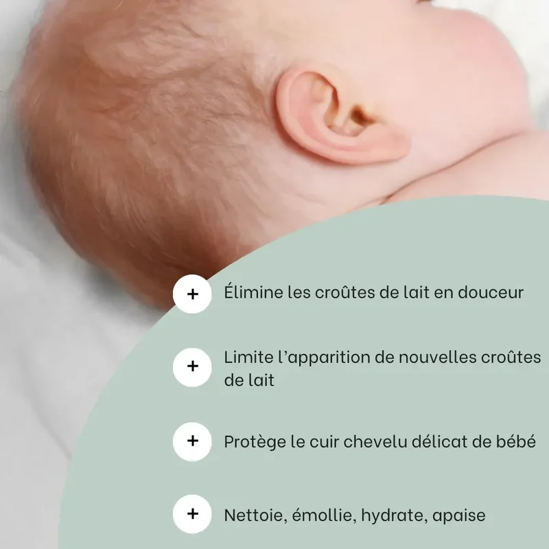 Les soins croûtes de lait