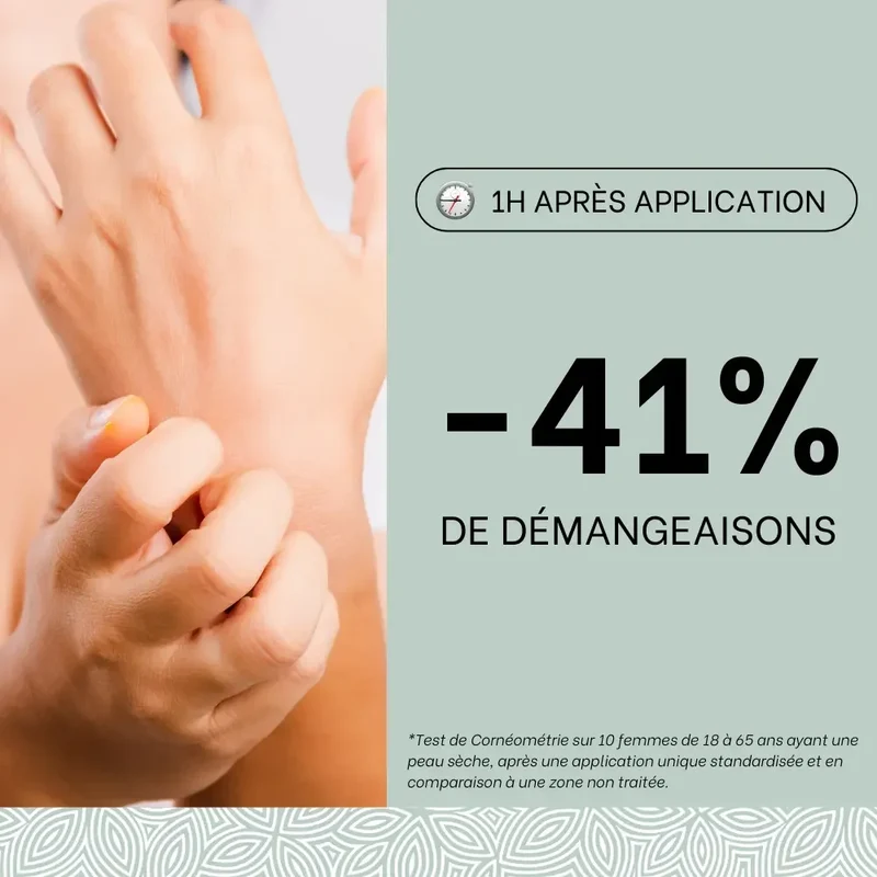 Trio eczéma des mains