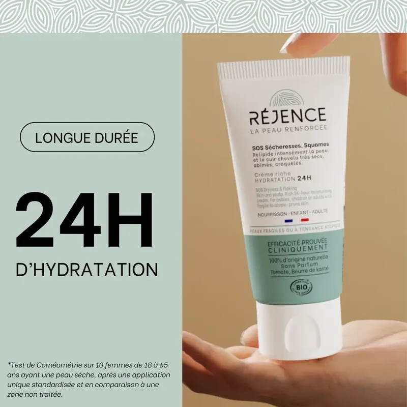 Trio eczéma des mains