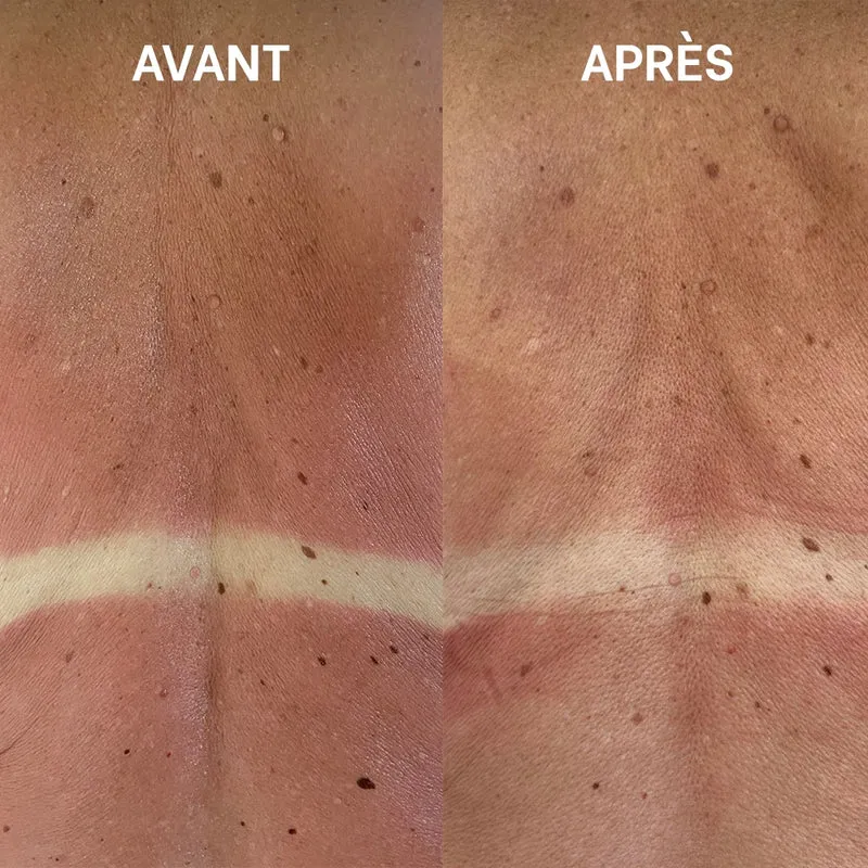 Duo après-soleil