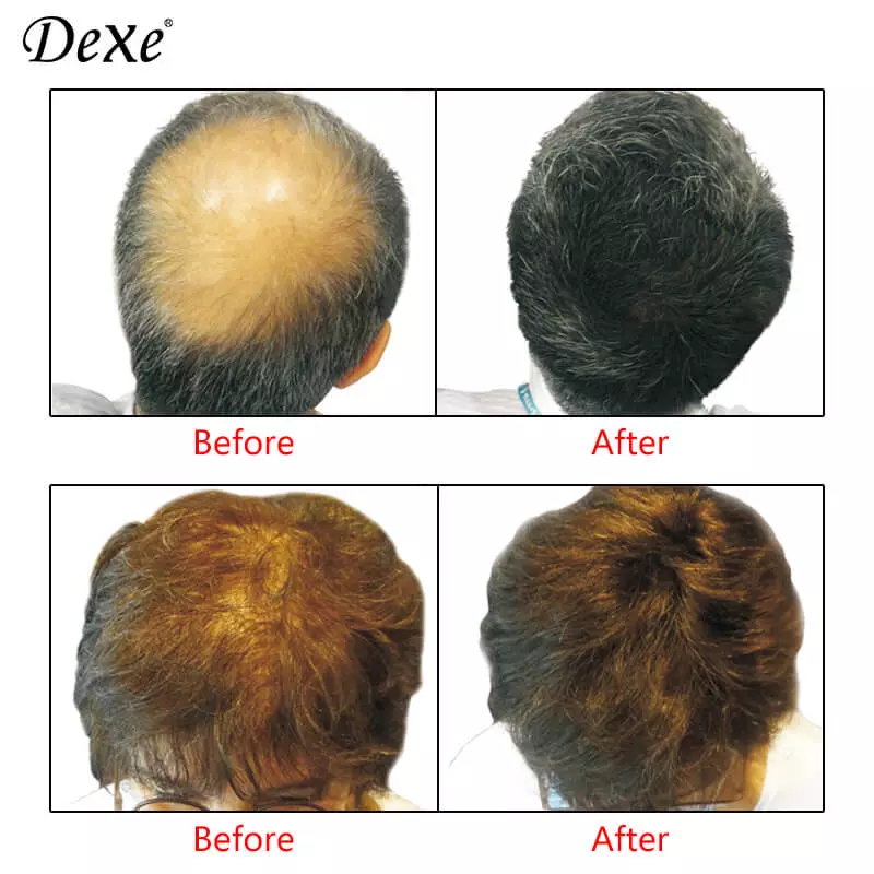 Dexe ≡ Fibre Capillaire Black 22g