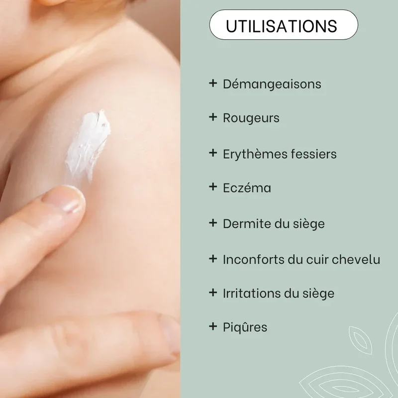 Cold cream SOS rougeurs, démangeaisons - 40mL - Bébé
