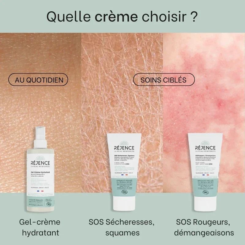 Cold cream SOS rougeurs, démangeaisons - 40mL - Bébé