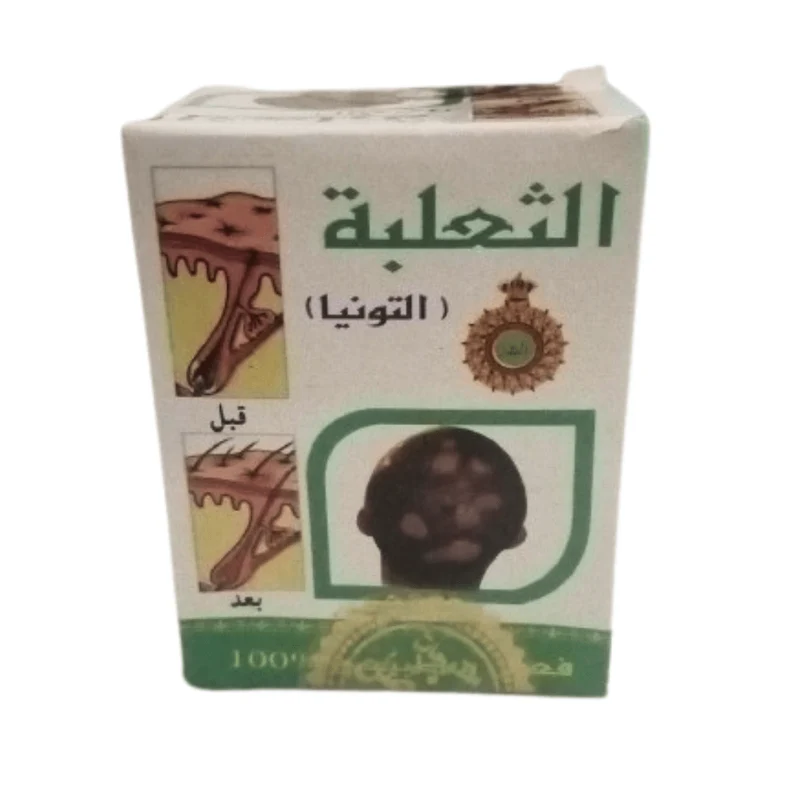 Crème Anti-Calvitie et Pelade Tounia Tâalaba