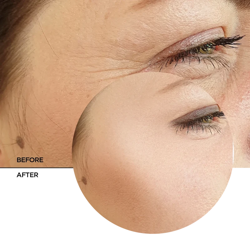 Retinol 0.3% + Niacinamide 5%