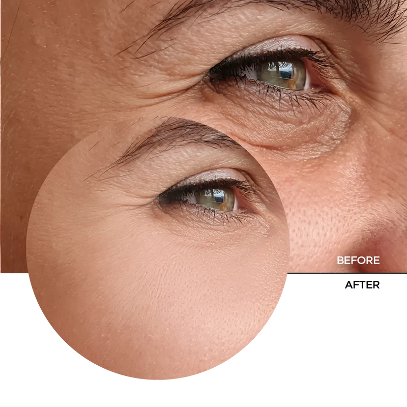 Retinal 0.2% Fluid
