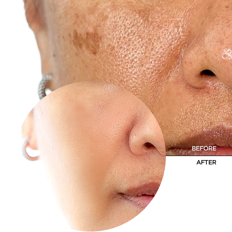 Biotic Resurfacing Activator