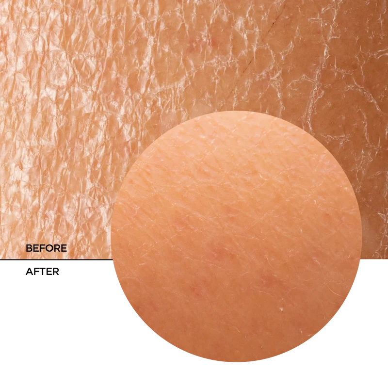 Biotic Regenerating Filling Balm