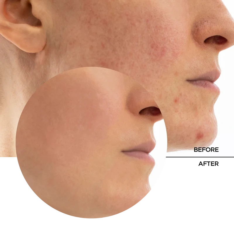 Biotic Rebalancing Smoothing Gel