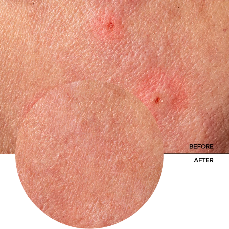 Provitamin B5 and Centella