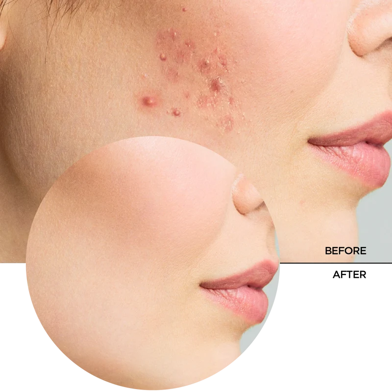 AHA BHA PHA Active Face Toner
