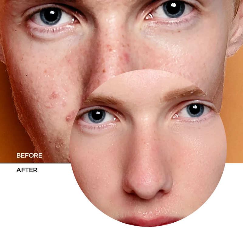 AHA BHA PHA Resurfacing Cream