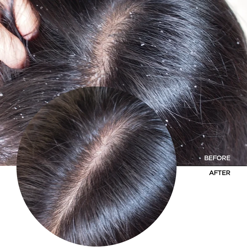 Hyaluronic Acid 2% for Hair