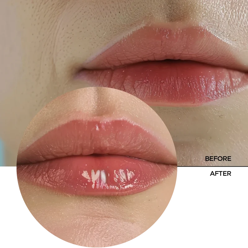Hyaluronic Acid