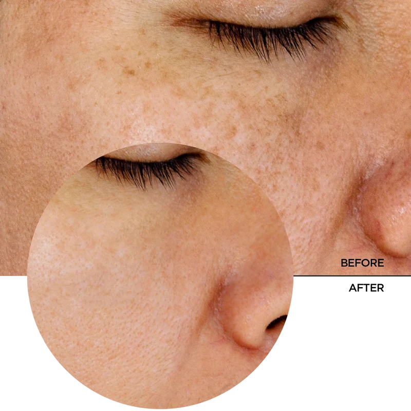 Glycolic Acid 7%