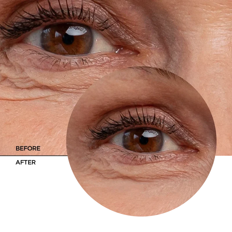 Eye Contour Gel