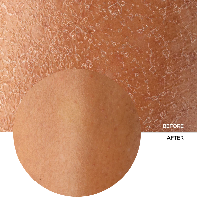 Marine Collagen + HA