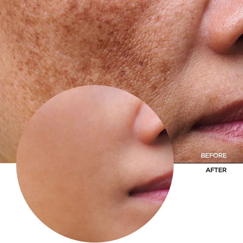 Mandelic Acid 10% + HA