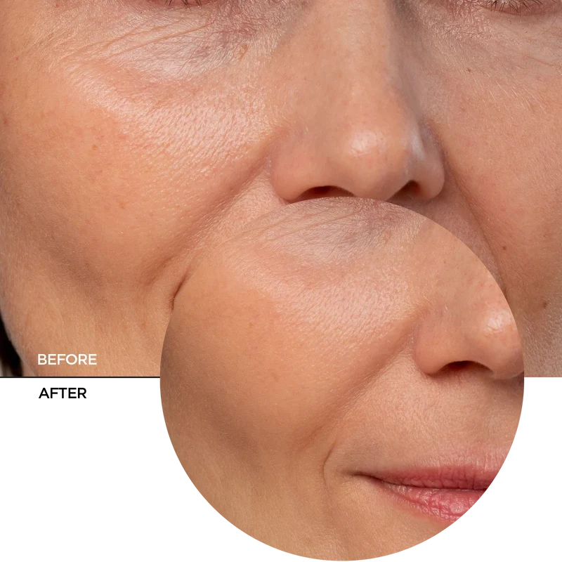 Coenzyme Q10