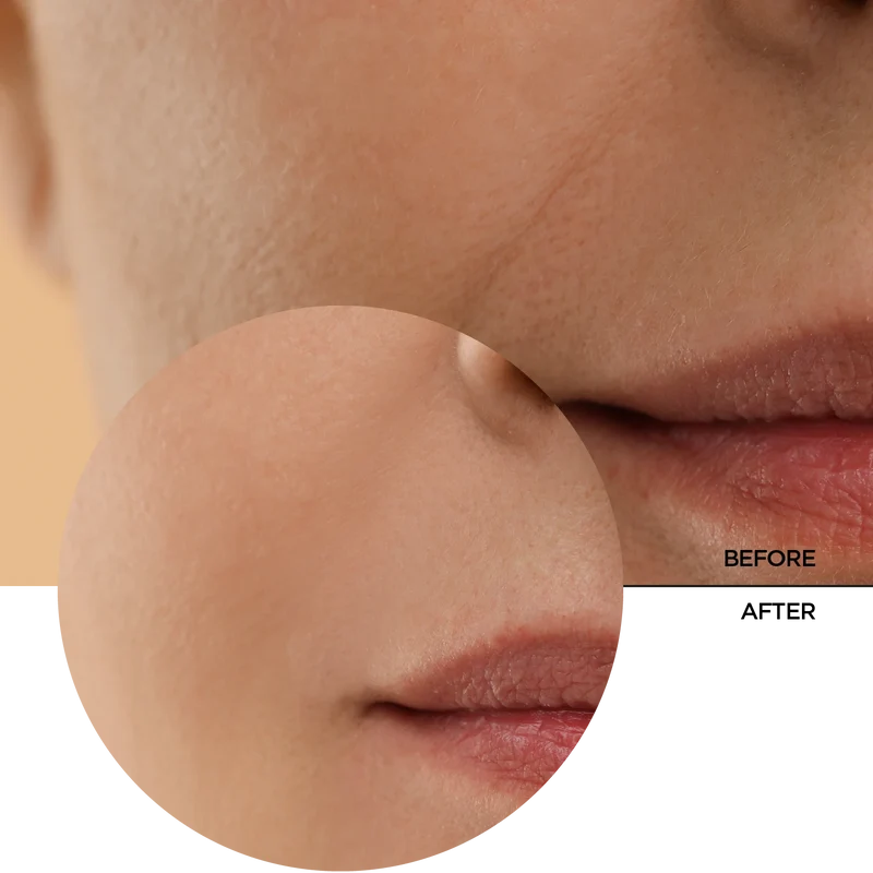 Retinol Toner