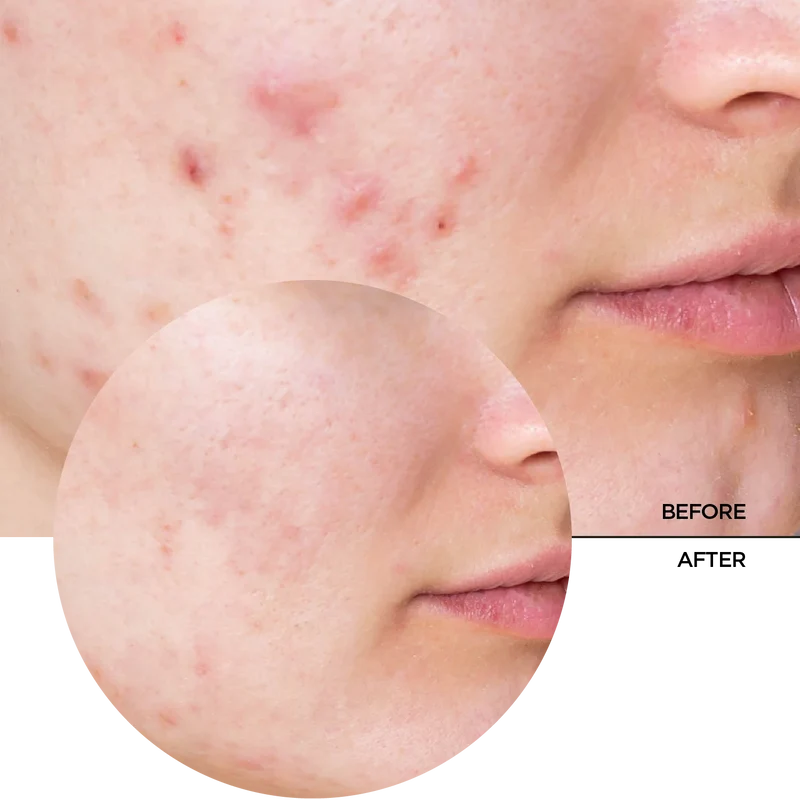 Niacinamide 10%