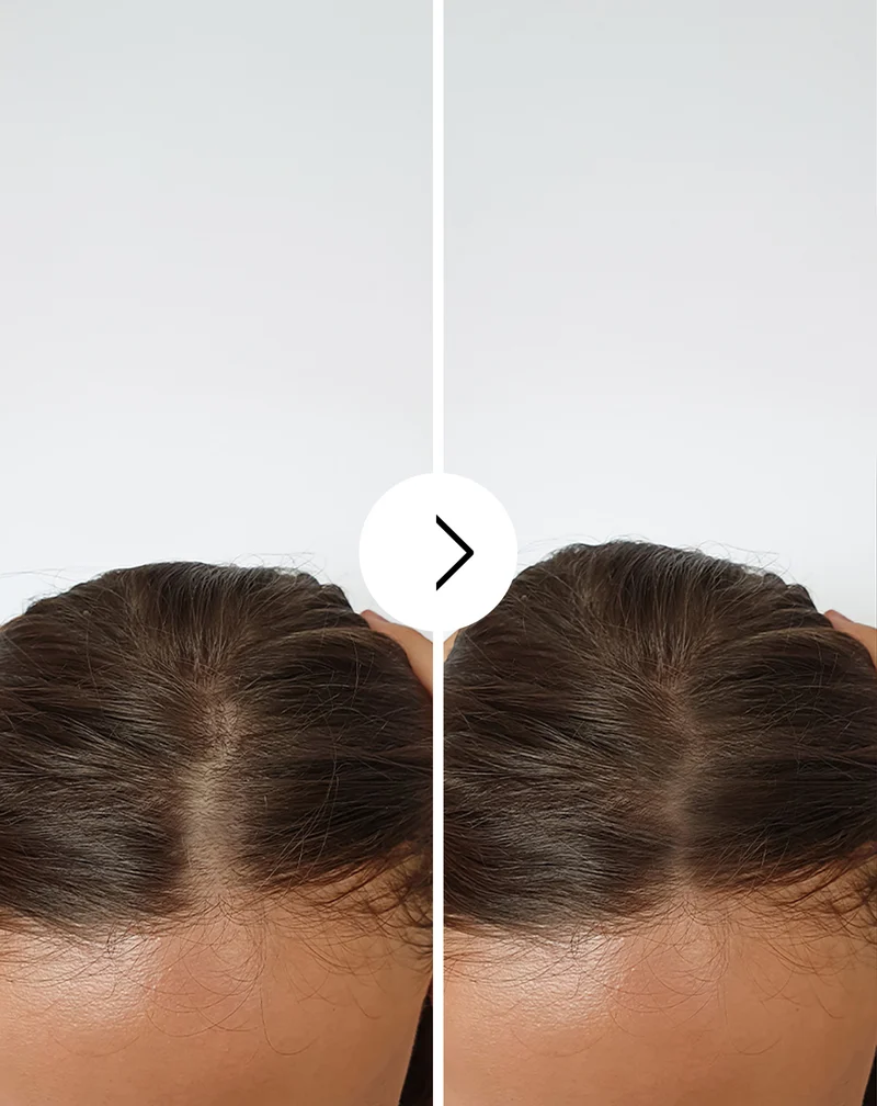 Gélules contre la chute des cheveux à effet épaississant et fortifiant Follixin 60 gélules
