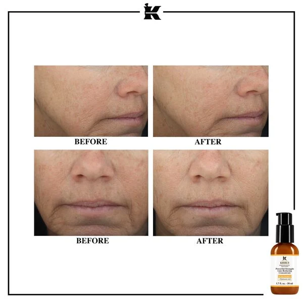 Kiehl’s - Powerful-Strength Line-Reducing Concentrate