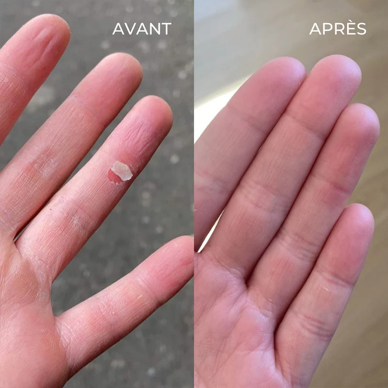 Le baume SOS multi-usages