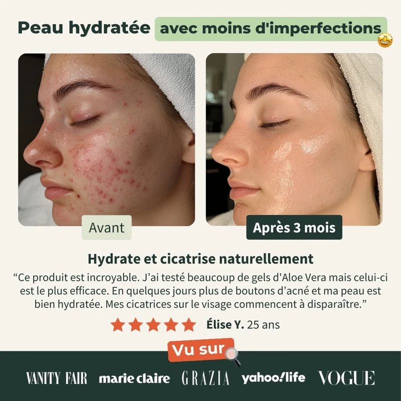 Gel Aloe Vera Bio + Huile Essentielle de Lavandin