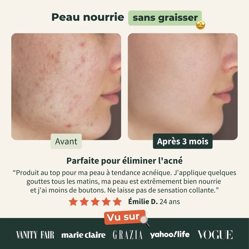 Huile de Jojoba Bio