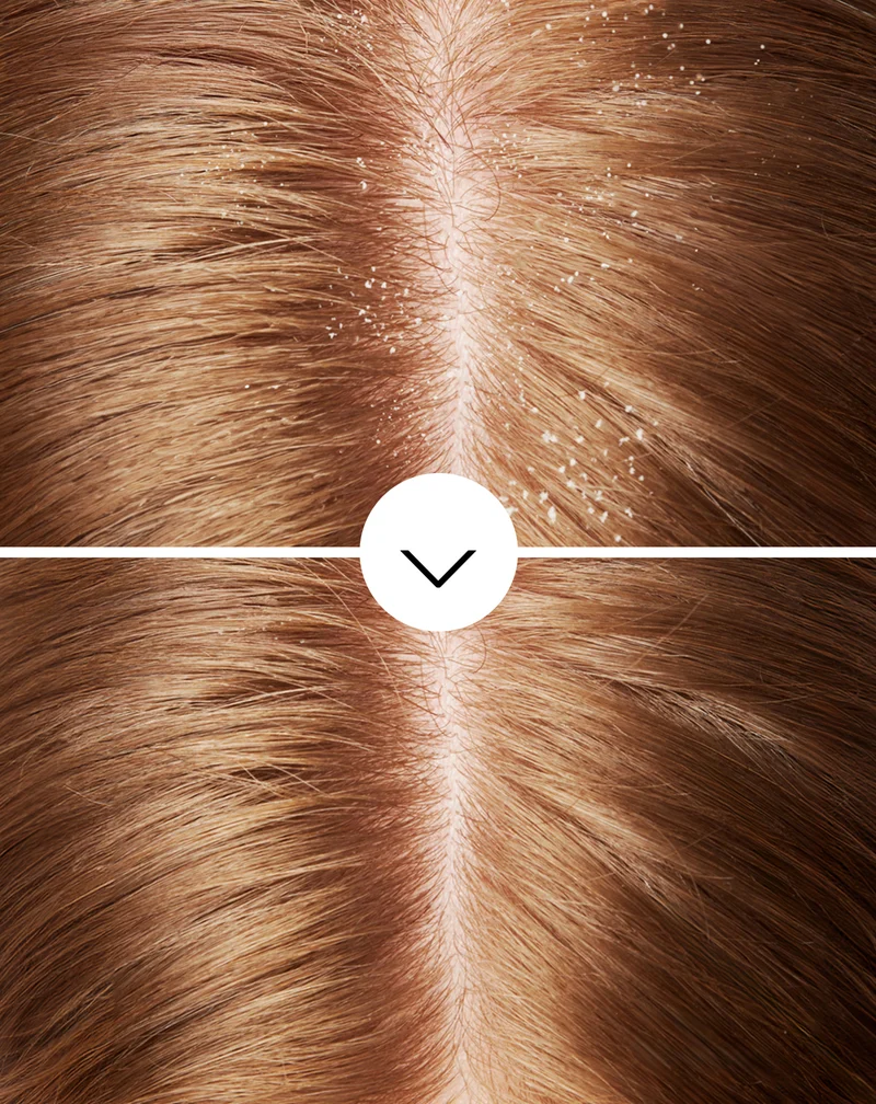 Shampoing antipelliculaire hydratant Nutridome à la piroctone olamine