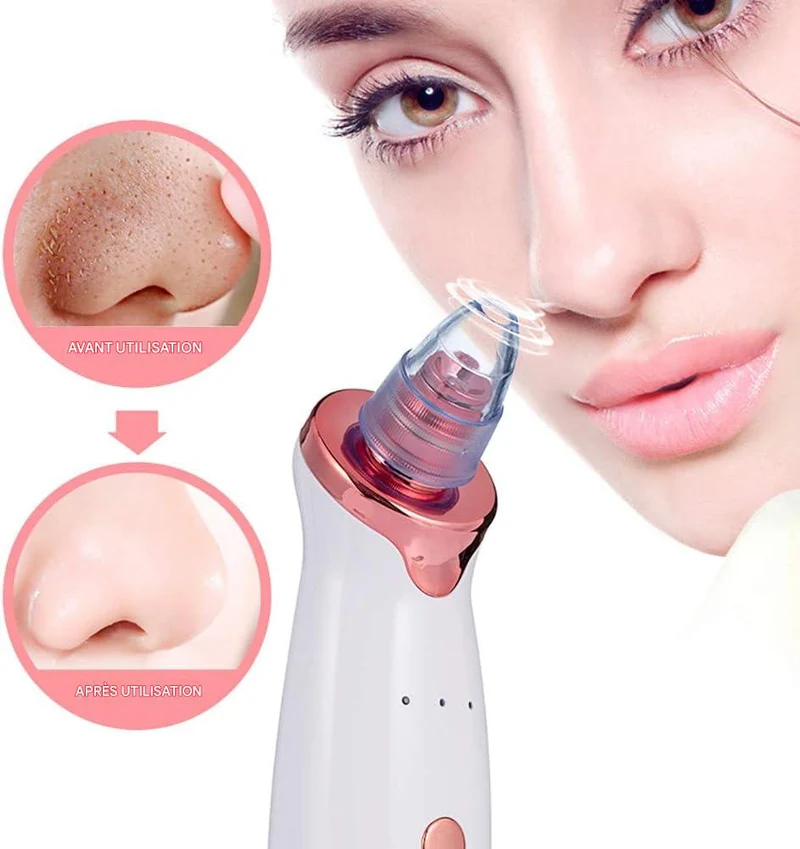 Aspirateur de points noirs "Multifunctional Cleaning Instrument"