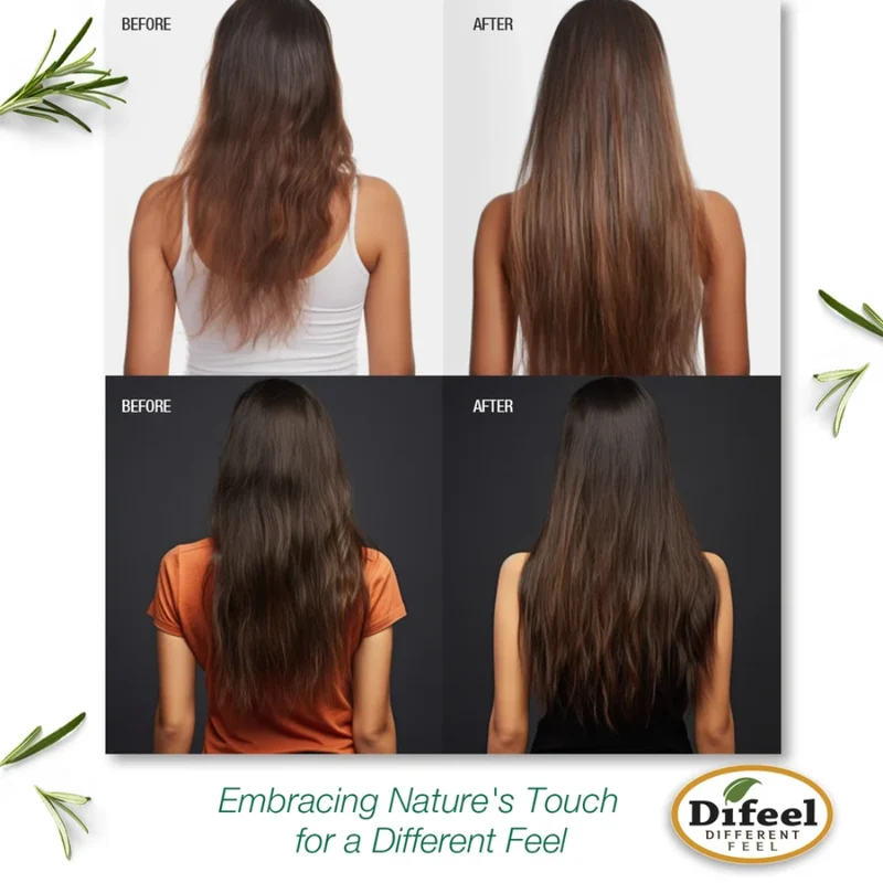 Difeel - Sérum pour le cuir chevelu Follicle Boost – Romarin et Menthe 118ml
