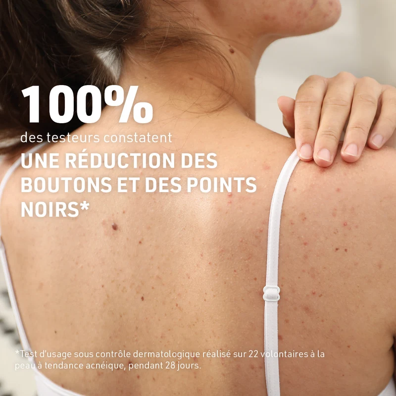 Sérum Corps Anti-Imperfections & Marques