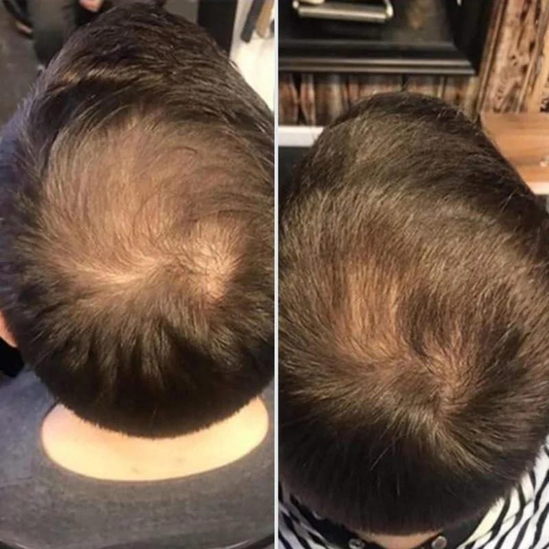 Après-shampooing grow perfect
