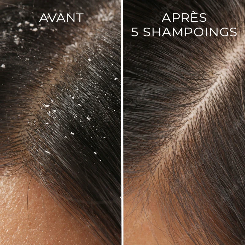 Shampoing traitant anti-pelliculaire Api'Propolis