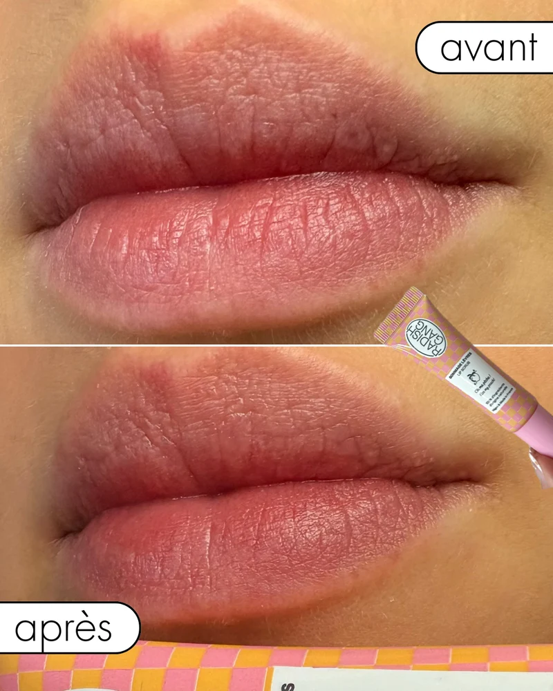 KISS MY PEACH